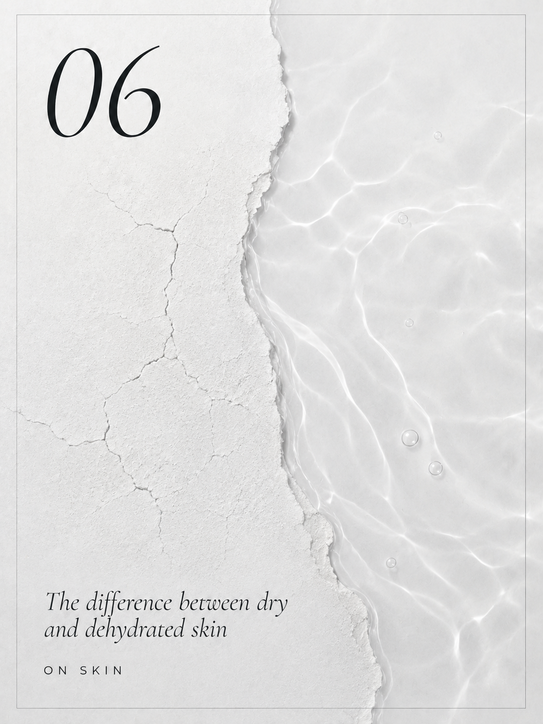 The difference between dry and dehydrated skin